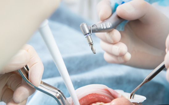 当院の一般歯科