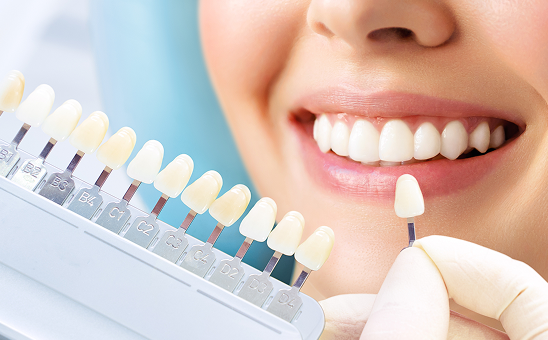 当院のホワイトニング